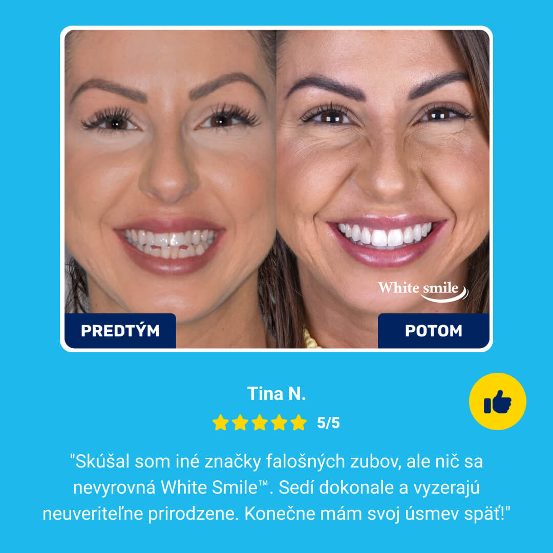WHITESMILE™ – Nastaviteľná Kozmetická Zubná Fazeta – Obrázok 7
